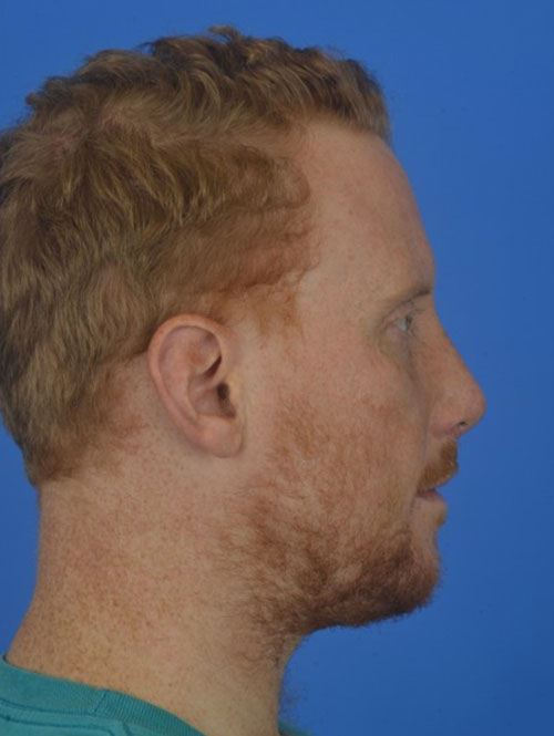 Patient Before & After Photo