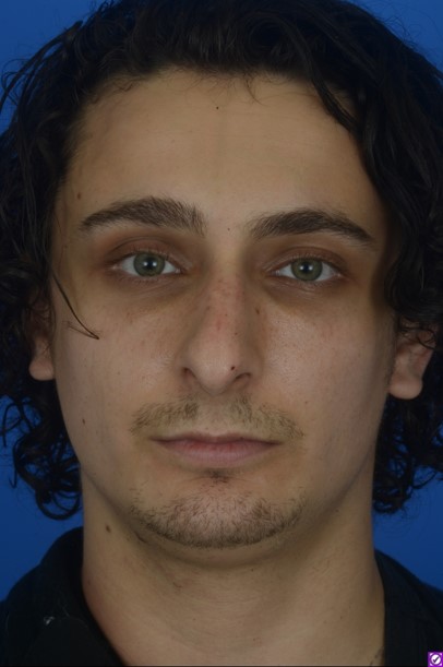 Patient Before & After Photo
